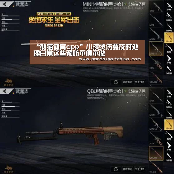 “熊猫体育app”小孩烫伤要及时处理日常这些预防不得不做(图1) 熊猫体育平台